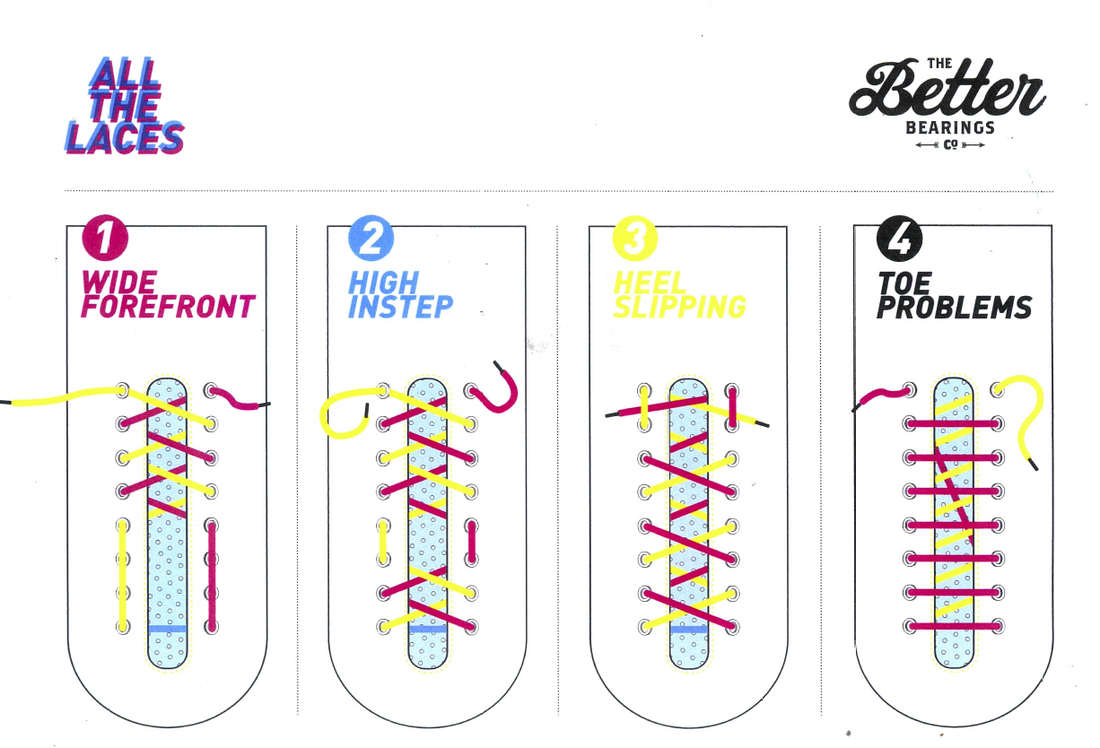 LACES